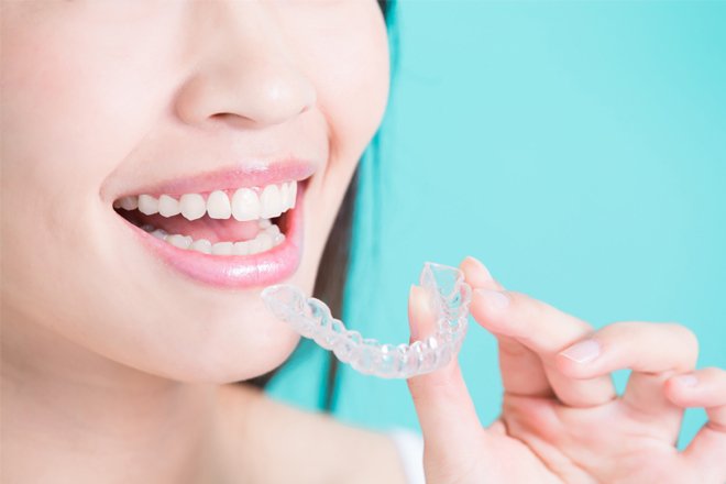 Invisalign