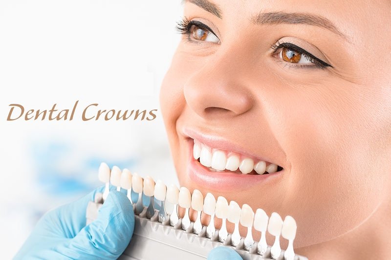 dental crowns