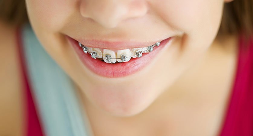 pediatric orthodontist