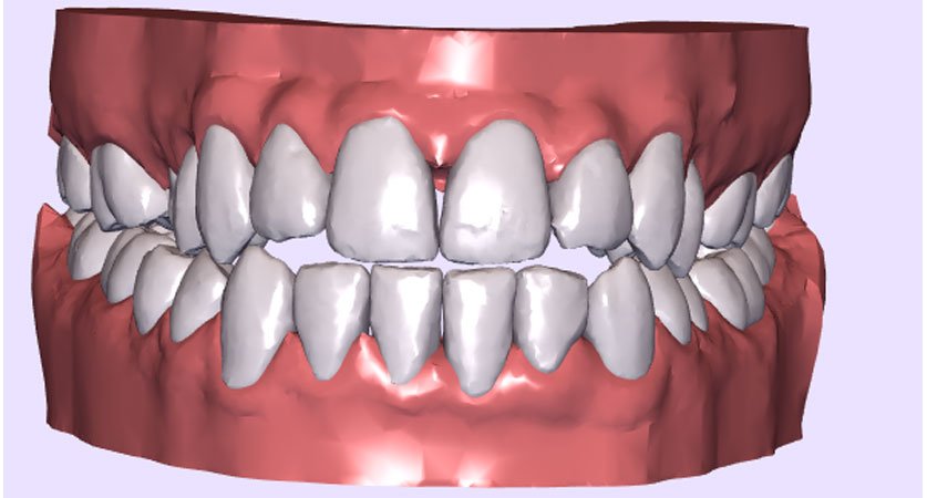 dental orthodontics