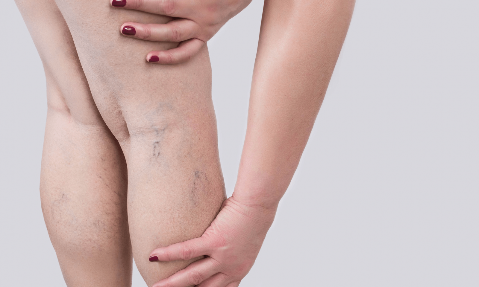 vein treatments