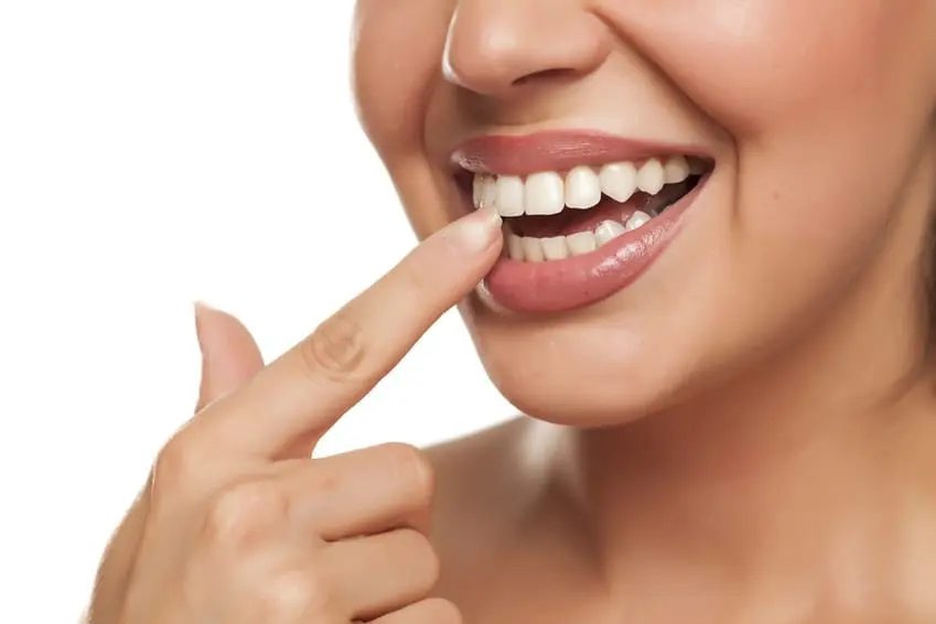 Invisalign north Miami beach