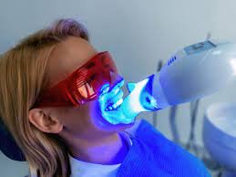 teeth whitening dentist near me in Peachtree City