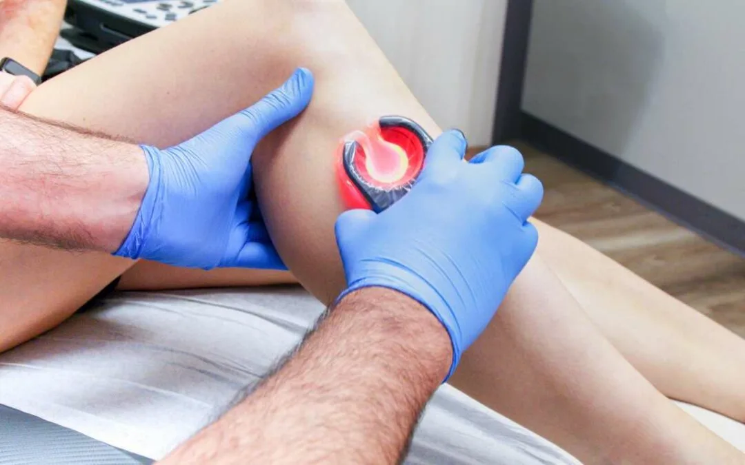 minimally invasive vein treatments in New York