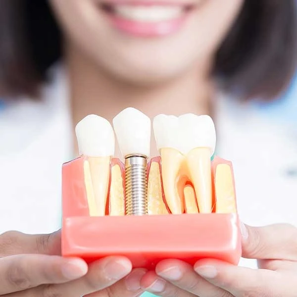 best implant dentist
