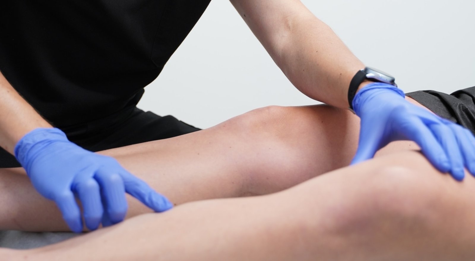 Vein Treatment Experts